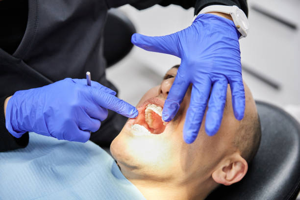 Best Emergency Gum Treatment in Providence, UT